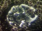 Aspergillus Pilze im Blut intra-& extrazellulär