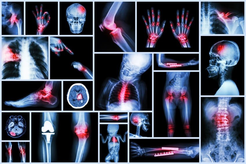 Orthopädische Erkrankungen – Verständlich erklärt